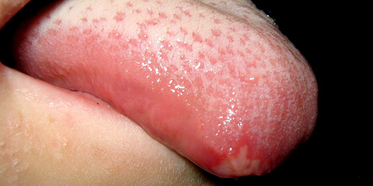 découvrez les meilleurs remèdes 2025 contre l’ulcère buccal chez le chat : solutions naturelles, conseils vétérinaires et astuces pour soulager rapidement la douleur de votre animal.