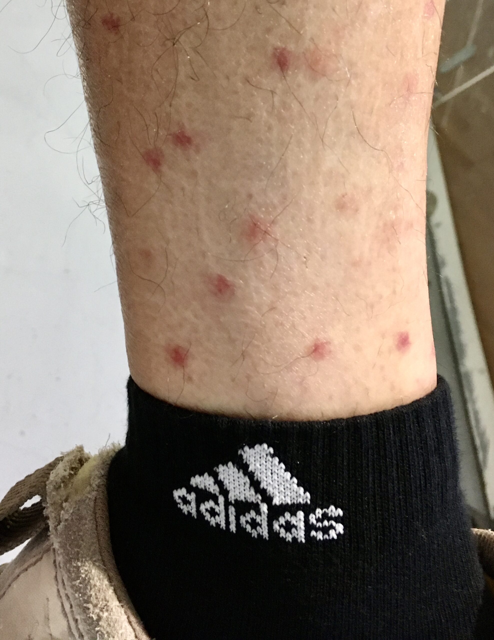 découvrez les symptômes des croûtes causées par les puces chez le chien et apprenez les traitements efficaces pour soulager votre animal et prévenir les infestations.