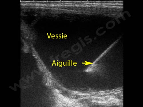 découvrez des solutions naturelles pour traiter la présence de sang dans les urines de votre chien. conseils, remèdes naturels et préventions pour améliorer la santé urinaire de votre animal.